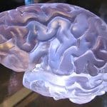 Foto de cerebro de exposición