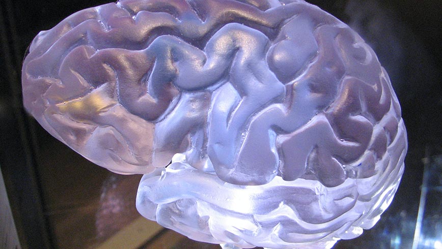 Foto de cerebro de exposición